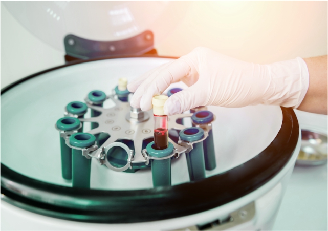 PRP-терапия в гинекологии (плазмолифтинг)