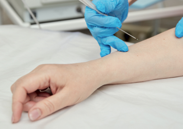 Лазерохирургическое лечение