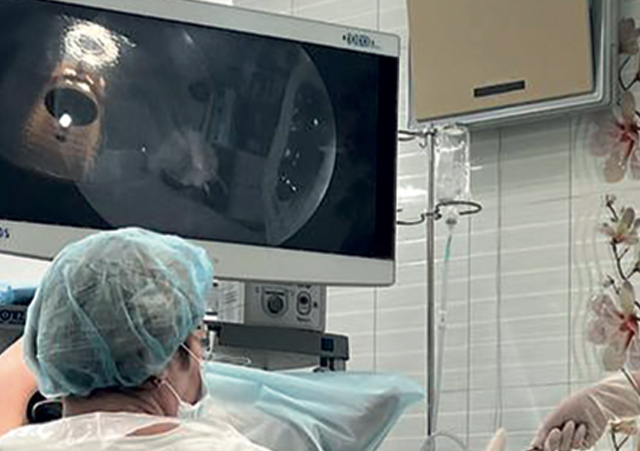 Гистерорезектоскопия