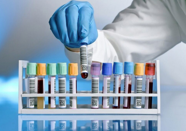 Лабораторные исследования